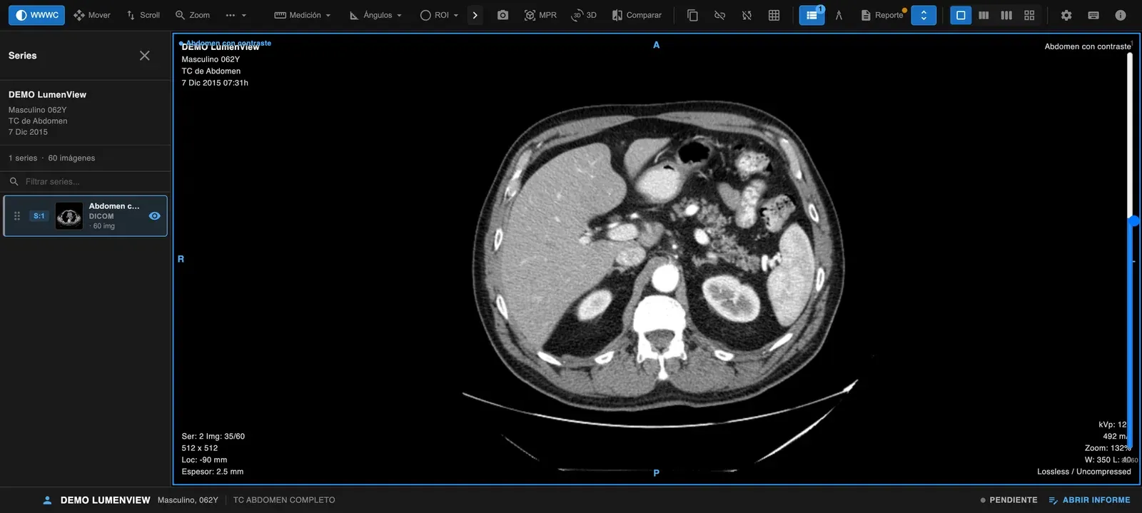 Captura de la bandeja del intérprete junto al visor DICOM abierto
